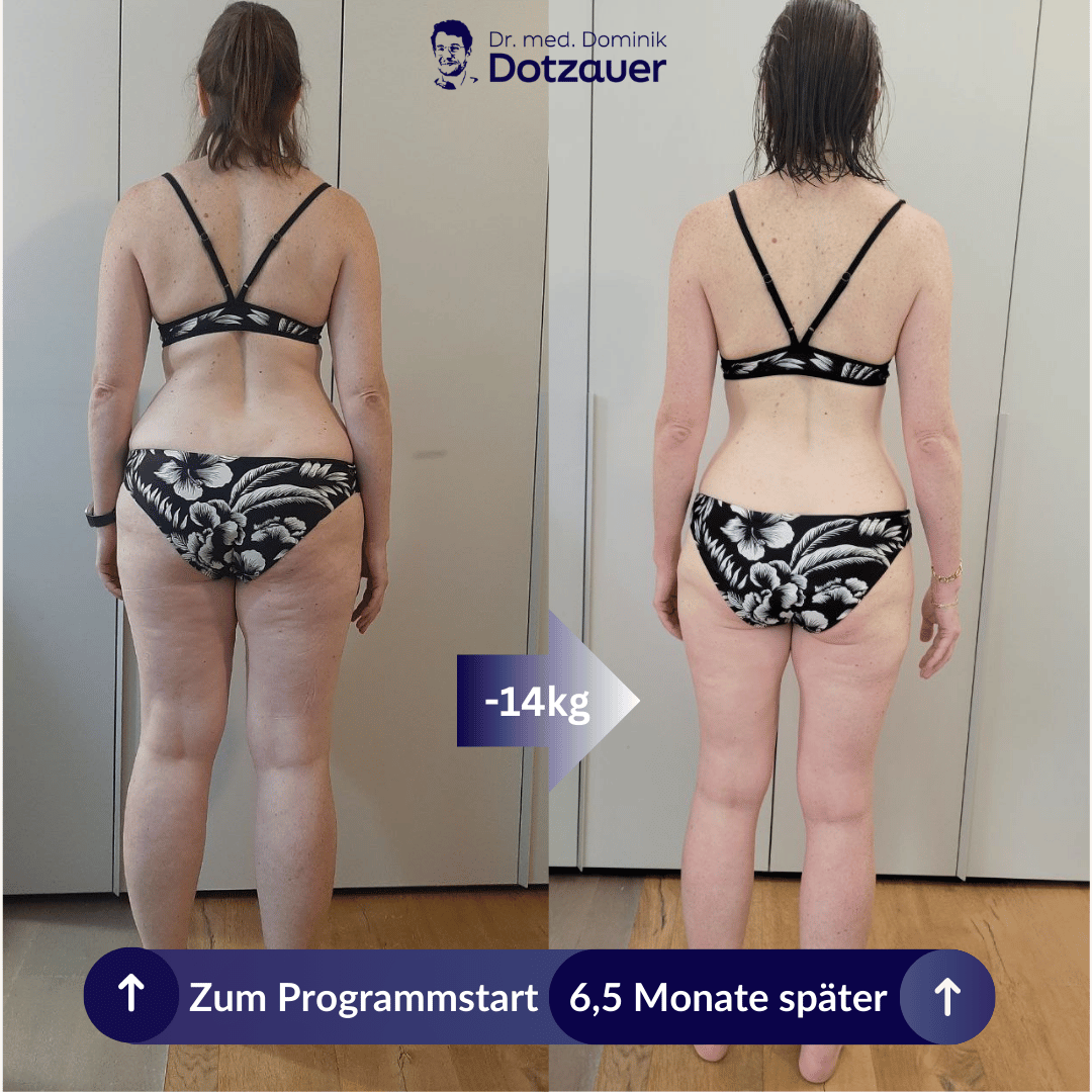 Kaline Transformation