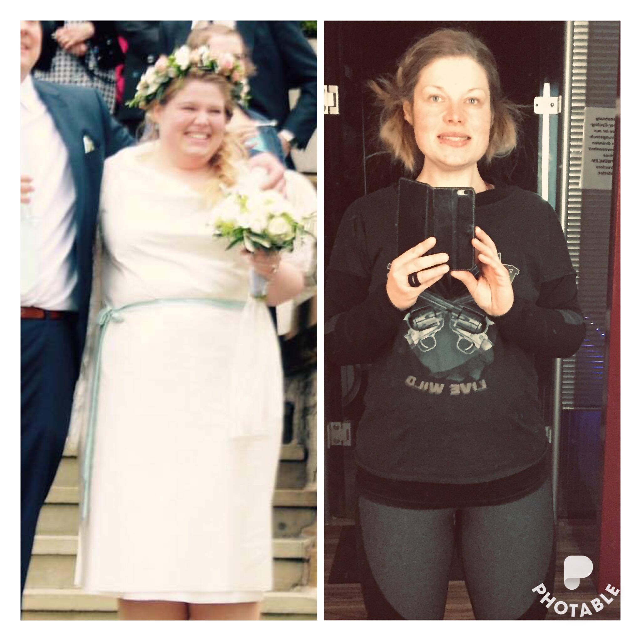 Leanne Vorher-Nachher