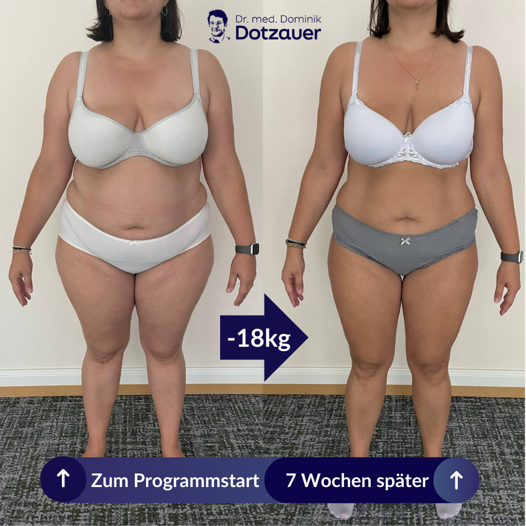 Vorher-Nachher Transformation