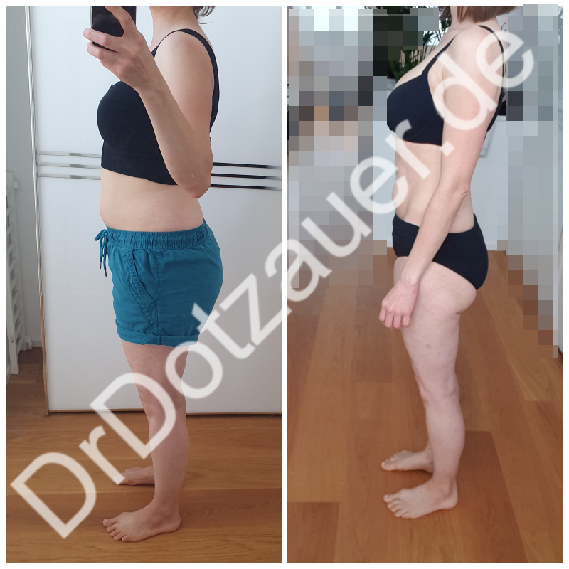 Vorher-Nachher nach 8 Wochen