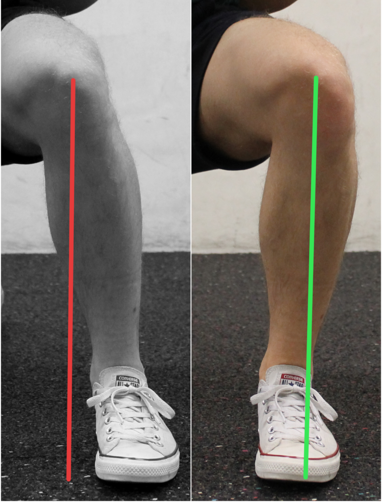 knie-reingefallen-vs-gerade-im-direkten-seitenvergleich