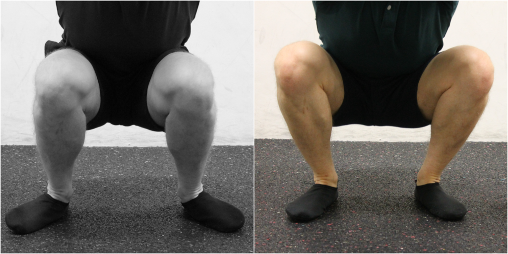 kniebeuge-knie-fallen-raus-fehler